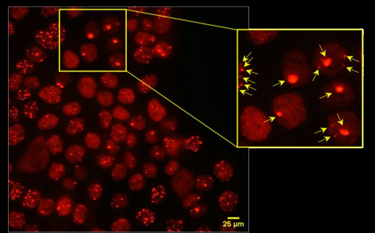 Fluorescence microscopy image of human keratinocyte nuclei