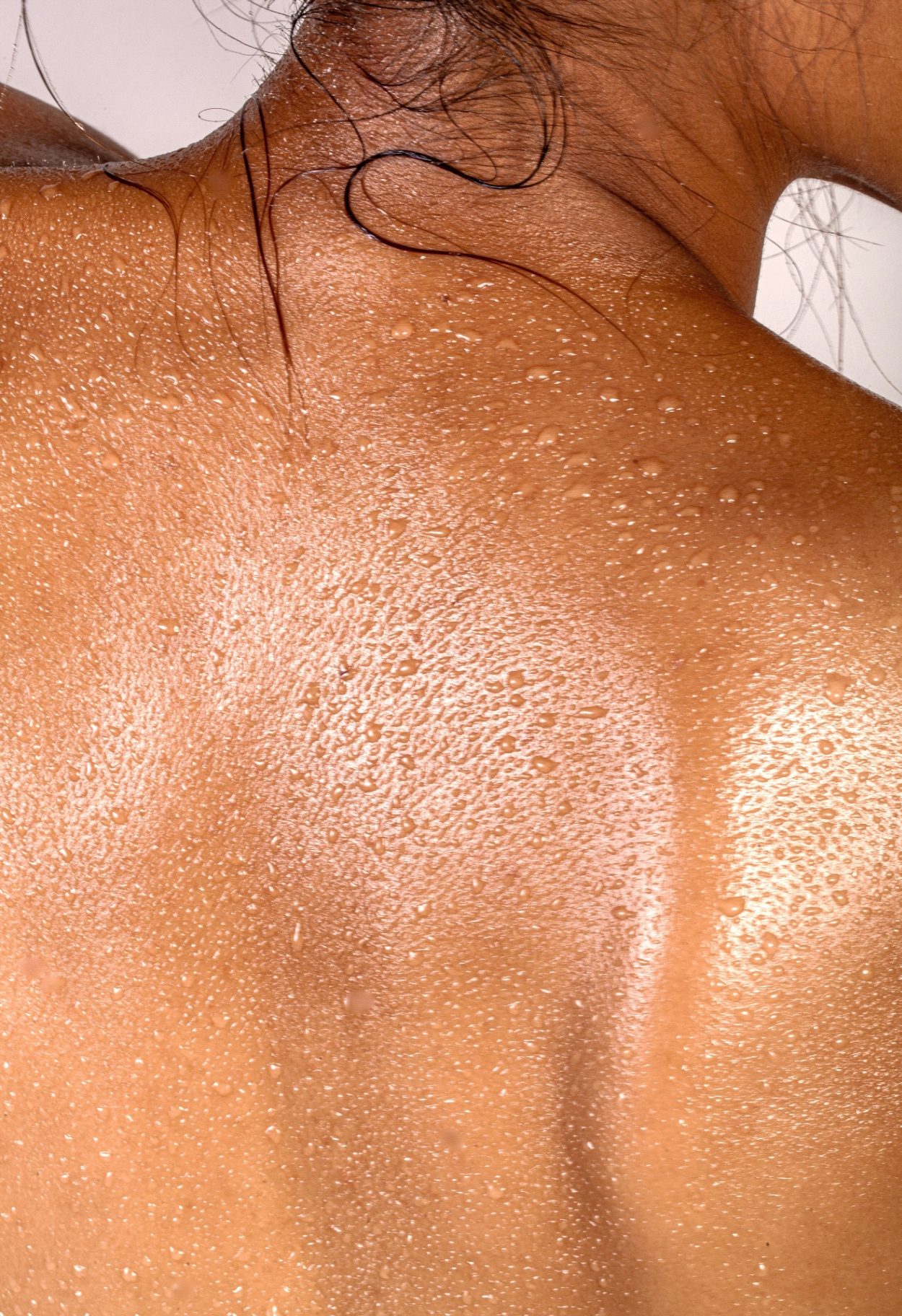 Collagen structure