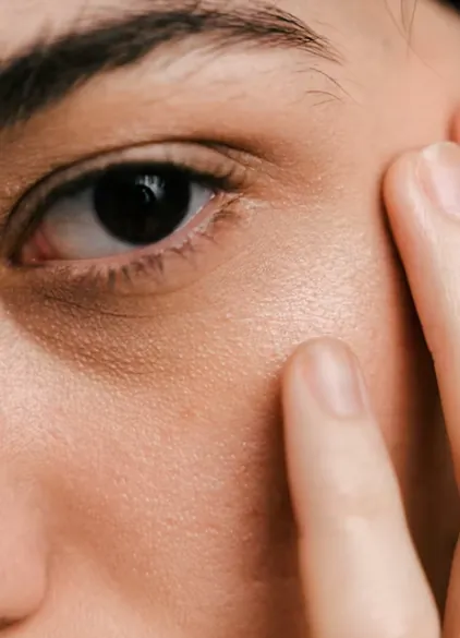 Skin close-up